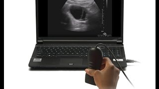 Ultrasound Video Challenge  OBGYN [upl. by Yolanda90]