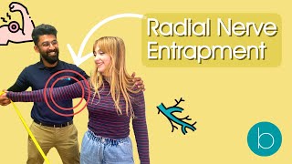 The Ultimate Guide to Radial Nerve Entrapment [upl. by Ecyor]