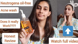 Neutrogena oilfree acne wash Honest Review  Best for oily amp Acne Prone skin not for dry skin [upl. by Salakcin667]