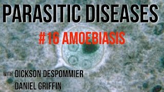 Parasitic Diseases Lectures 16 Amoebiasis [upl. by Inez323]