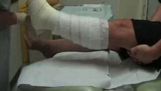 Wound Management  How to apply a single layer high compression bandage [upl. by Eicak]