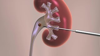 Nephrology  Glomerular Filtration [upl. by Halludba]