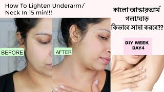 How To Lighten Dark UnderarmNeck Instant Result in 15 min  natural way  Shahnaz Shimul [upl. by Panchito890]