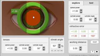 Simulador retinoscopia [upl. by Northway654]