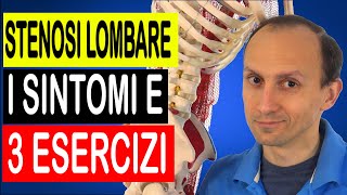 Stenosi Lombare i Sintomi e i 3 Esercizi Migliori Testati [upl. by Luigino244]