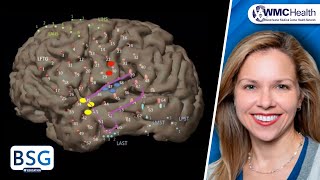 Temporal Lobe Epilepsy Seminar 1 Overview [upl. by Alig]