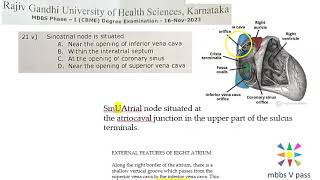 Anatomy Thorax 288 SinoAtrial Node location SinuAtrial Heart SVC Solved Question Paper MCQ [upl. by Aihsile]