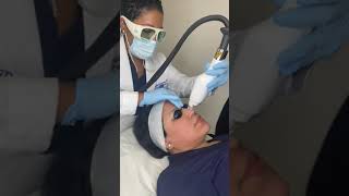 LaseMD™ Skin Resurfacing Treatment at Premier Pain Care amp Wellness [upl. by Fitzhugh]