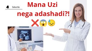 MANA NIMA UCHUN UZI HOMILA JINSINI XATO AYTADI😨😱😱😱❌❌❌❌❌❌❌❌ BUNI BILISHINGIZ SHART🔥💯🆘🆘🆘🆘✅✅✅ [upl. by Nrublim]