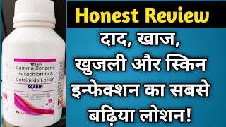 Scabin Lotion Review  Gamma Benzene Hexachloride amp Cetrimide Lotion  Uses and Benefits  in Hindi [upl. by Antoine]