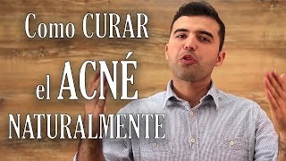 Como Curar el Acne Naturalmente [upl. by Gennie99]