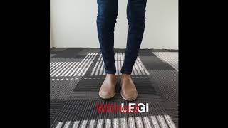 The Joy of LegiBowed legs Cosmetic Calf Support without surgery [upl. by Range]