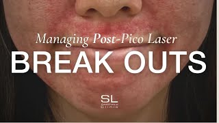 The Ultimate Guide to Managing Post Pico Laser Breakouts [upl. by Rosemary]