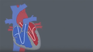 Congenital Heart Defects CHDs [upl. by Adnuahsor]