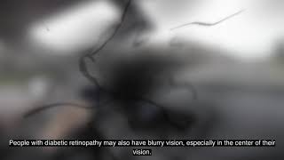 How Diabetes Affects Your Eyes Retinopathy Glaucoma Cataracts Macular Edema [upl. by Ial]