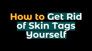 How to Get Rid of Skin Tags Yourself [upl. by Papst]