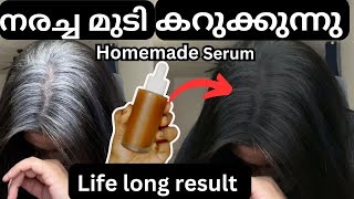 Reverse Greying Hair Naturally😱✨✅YES Really it’s working🙀 💯 Best Result with in days [upl. by Camila]