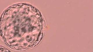 Human Blastocyst Artificial Collapse with Laser Fertility Specialists of Texasavi [upl. by Dobbins341]