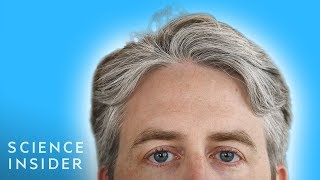 Why Some Peoples Hair Turns Gray [upl. by Seif]