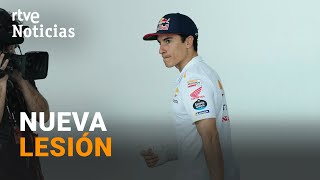 MARC MÁRQUEZ OPERADO de un DEDO de la MANO se perderá el GRAN PREMIO de ARGENTINA  RTVE [upl. by Jezabel]