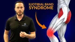 Knee Pain Relief ITB Syndrome Stretches [upl. by Yemiaj]