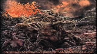 FULL ALBUM Postcoital Ulceration  Continuation of Defective Existence After Multiple [upl. by Colt]