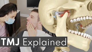 TMJ Explained  Jaw Pain Causes amp Symptoms [upl. by Noraha200]