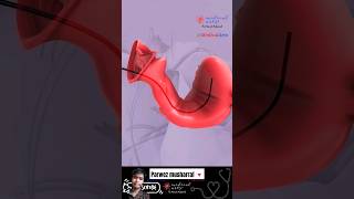 Brachytherapy cervical cancer shorts knowledge animation [upl. by Willa]