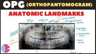 Orthopantomogram OPG Anatomical Landmarks  Panoramic Radiography landmarks  Radiology [upl. by Aneej]