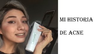 ►mi historia de acné tratamiento kitoscell [upl. by Wivinah44]