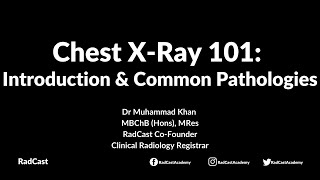 RadCast Academy Introduction To The Chest XRay amp Common Pathologies cxr radcast [upl. by Leler]