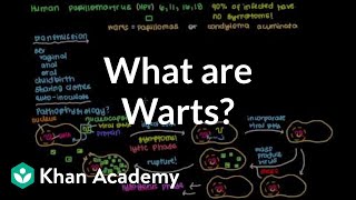 Understanding the Causes and Treatments of Plantar Warts [upl. by Enneiviv]