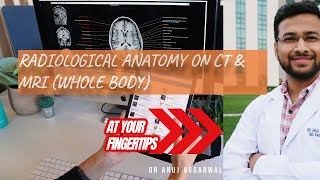 Learn Radiological anatomy on CT amp MRI of any body part using a free mobile app radiology [upl. by Hallagan]