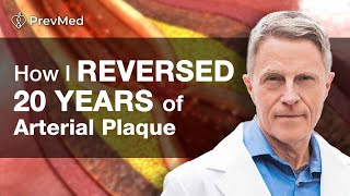 How I Reversed 20 years of Arterial Plaque [upl. by Itsa]