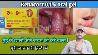 Kenacort 01 oral gel use dose benefits and Side effects full review in hindi [upl. by Yarised]