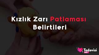 Kızlık Zarı Patlaması Belirtileri [upl. by Lekar]