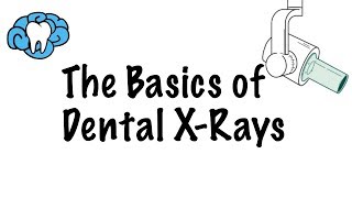 How to Read Dental XRays [upl. by Lorraine]