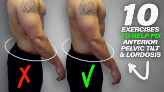 10 Exercises to Help Fix Anterior Pelvic Tilt amp Lordosis [upl. by Olodort]