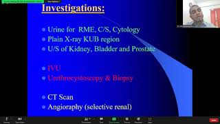 Haematuria and Bladder outlet obstruction BOO by Dr Asaduzzaman sir [upl. by Nylodnewg]