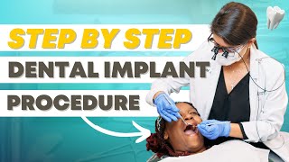 Dental Implant Steps  What to Expect During Your Implant Procedure [upl. by Glorianna]