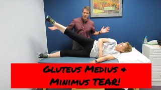 Gluteus Medius and Minimus tear vs Greater Trochateric Bursitis [upl. by Alane]