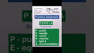 Pupils examination  pupillary assessment eyeexamination [upl. by Cacilia65]