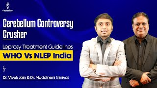 Cerebellum Controversy Crusher Leprosy Treatment Guidelines WHO Vs NLEP India [upl. by Inoue]