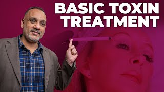 Basic Botox Toxin Injection for the Upper Face Forehead Frown Lines and Eyes  BTC Training [upl. by Brit]