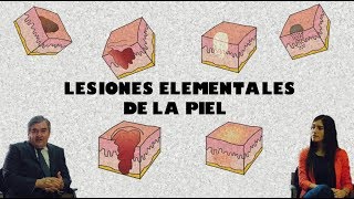 Lesiones Elementales de la Piel [upl. by Hanavas]