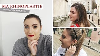 MA RHINOPLASTIE l AvantAprès mon expérience le prix etc [upl. by Klemperer]