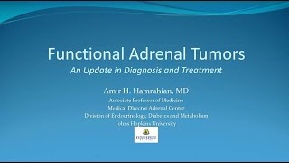 Adrenal gland Adrenocortical adenoma  Talking slide [upl. by Einnaf]