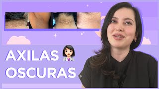 🥲¿Axilas oscuras Tips para cuidarlas [upl. by Airtemed973]