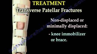 Patellar Fractures  Everything You Need To Know  Dr Nabil Ebraheim [upl. by Ohnuj726]