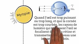 Myopie symptômes et traitement [upl. by Fesuy]